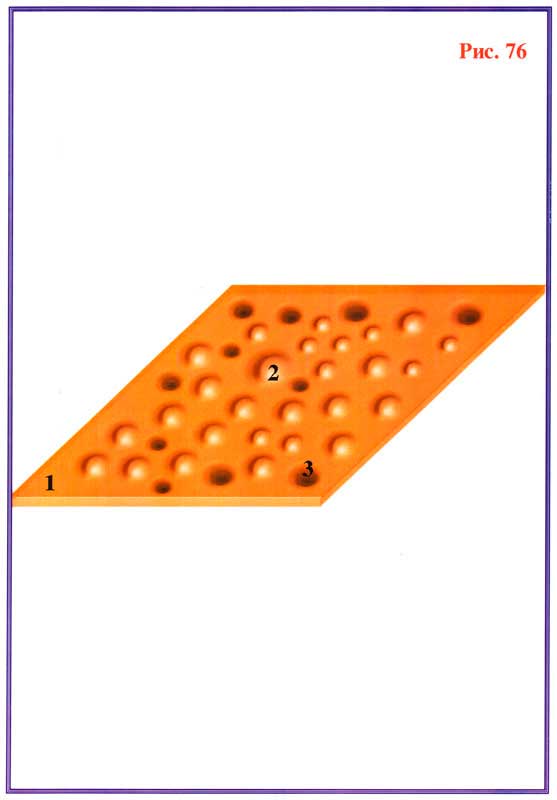 Fig 76